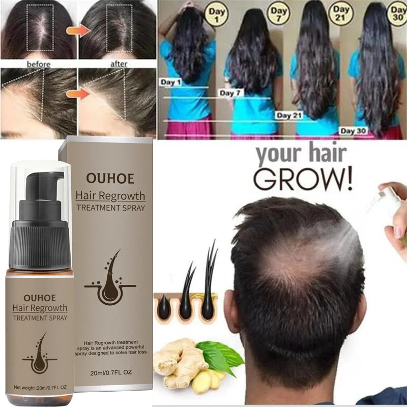 Fast Hair Growth Spray Products anti Hair Loss Serum Prevent Baldness Treatment Scalp Dry Damaged Essential Oil Hair Beauty