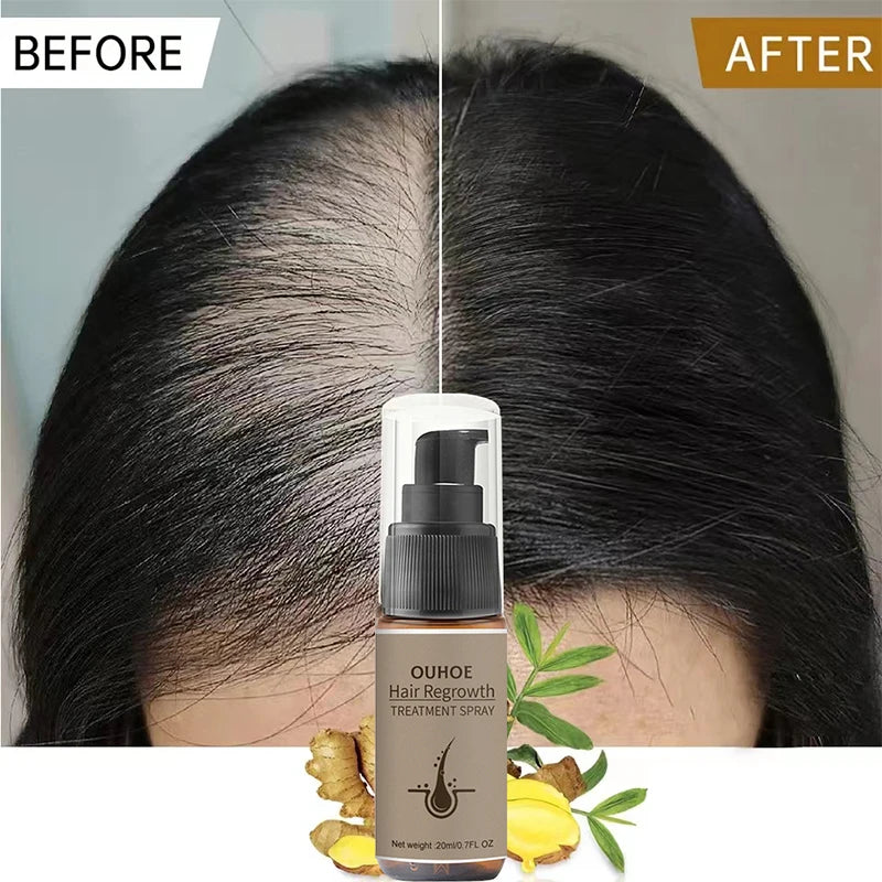 Fast Hair Growth Spray Products anti Hair Loss Serum Prevent Baldness Treatment Scalp Dry Damaged Essential Oil Hair Beauty