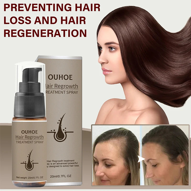 Fast Hair Growth Spray Products anti Hair Loss Serum Prevent Baldness Treatment Scalp Dry Damaged Essential Oil Hair Beauty